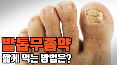 발톱무좀약, 단기간만 먹는 방법은 없을까?