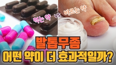 발톱무좀이 고민인 분들은 꼭 보세요