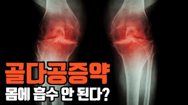 골다공증약 이때 먹어야 효과 있다?