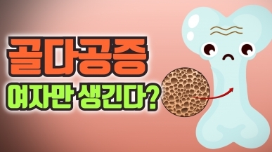 여자만 골다공증에 걸린다는 얘기의 진실